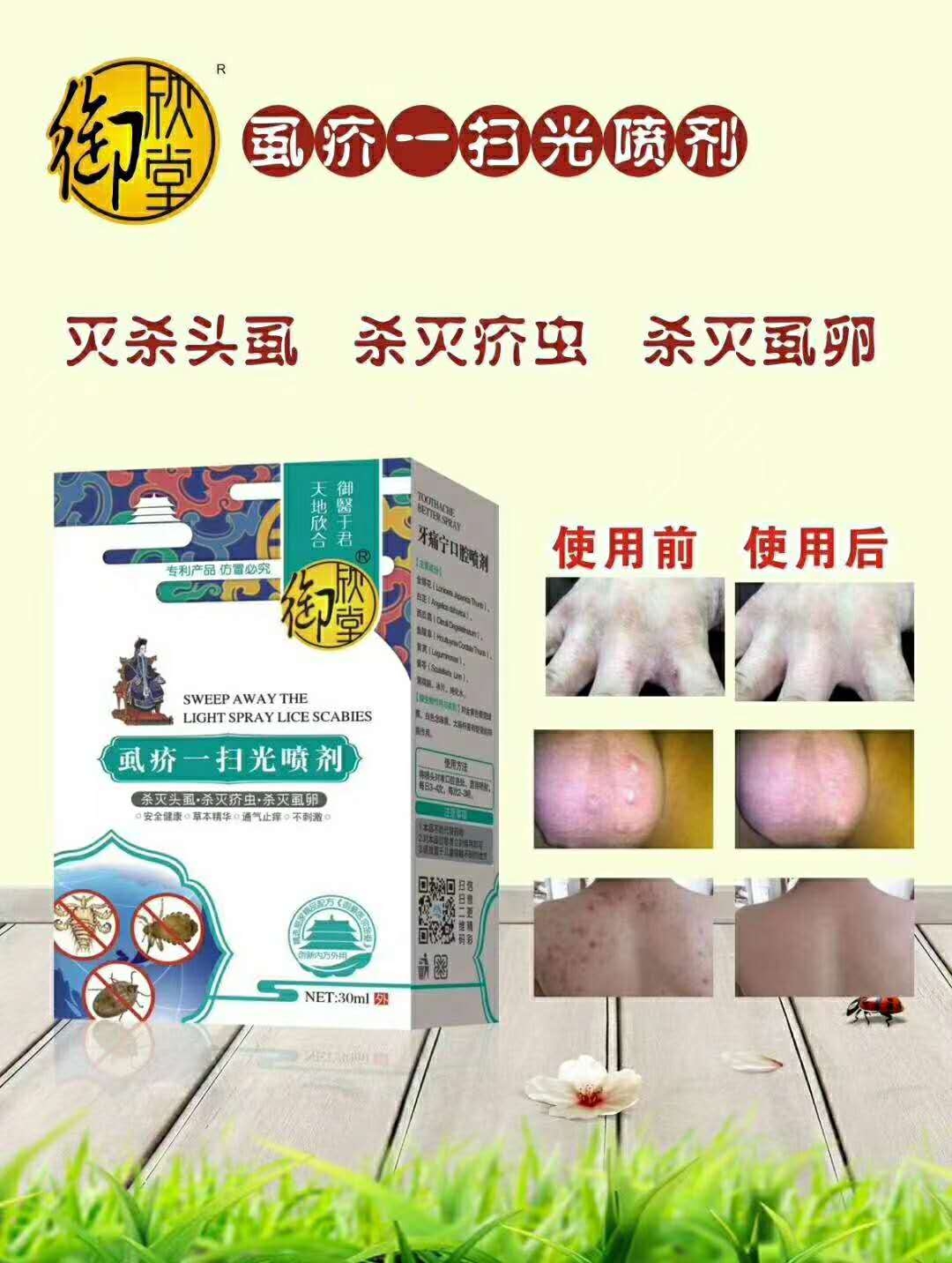 虱疥一扫光喷剂*御欣堂